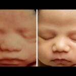 Third-Trimester Mind-Blow: Not What It Looks Like Ultrasound Me baby ki smile 😊 / ultrasound video/sonography / ultrasound baby smile ☺️ #ultrasound