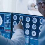 Doctors reviewing brain MRI scans on multiple monitors