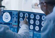 Doctors reviewing brain MRI scans on multiple monitors